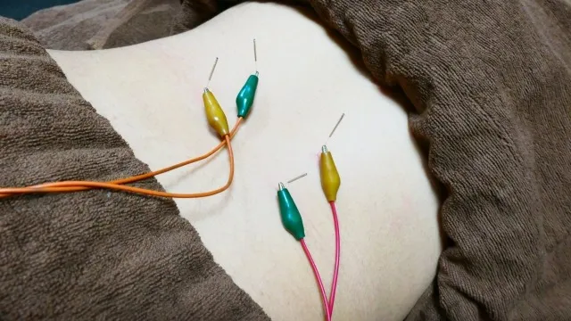 背中や脇腹の激痛で眠れない…その痛み、鍼灸で改善できる可能性があります